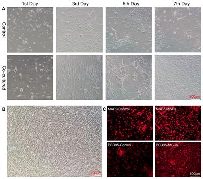 Human umbilical cord-derived mesenchymal stem cells alleviate valproate-induced immune stress and social deficiency in rats